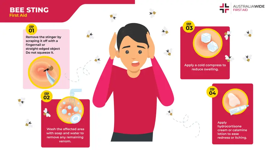 first-aid-for-bee-stings